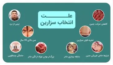 کمیسیون بررسی علت سزارین تشکیل شد